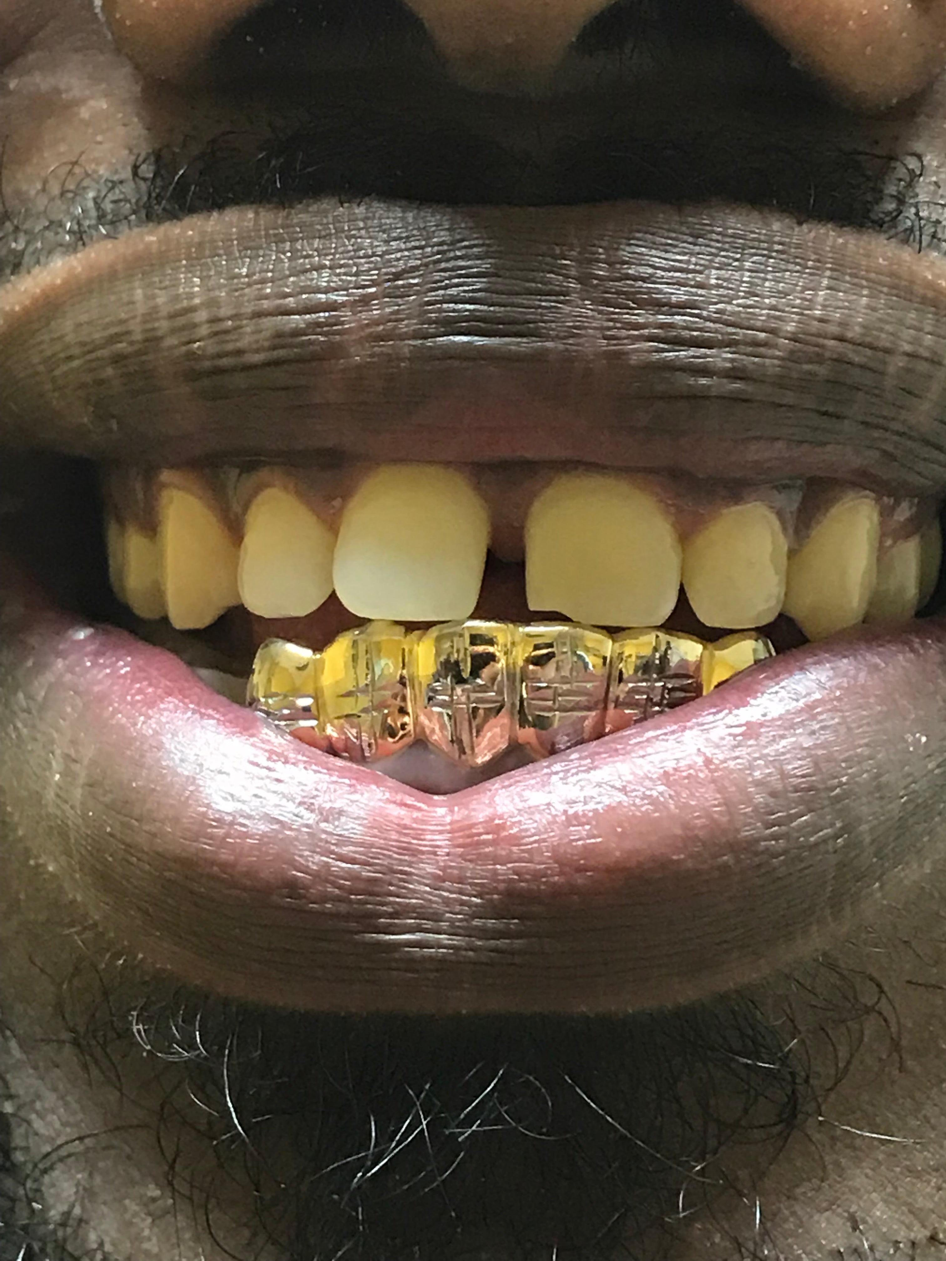 6 10k Gold Teeth