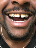2 Silver Teeth