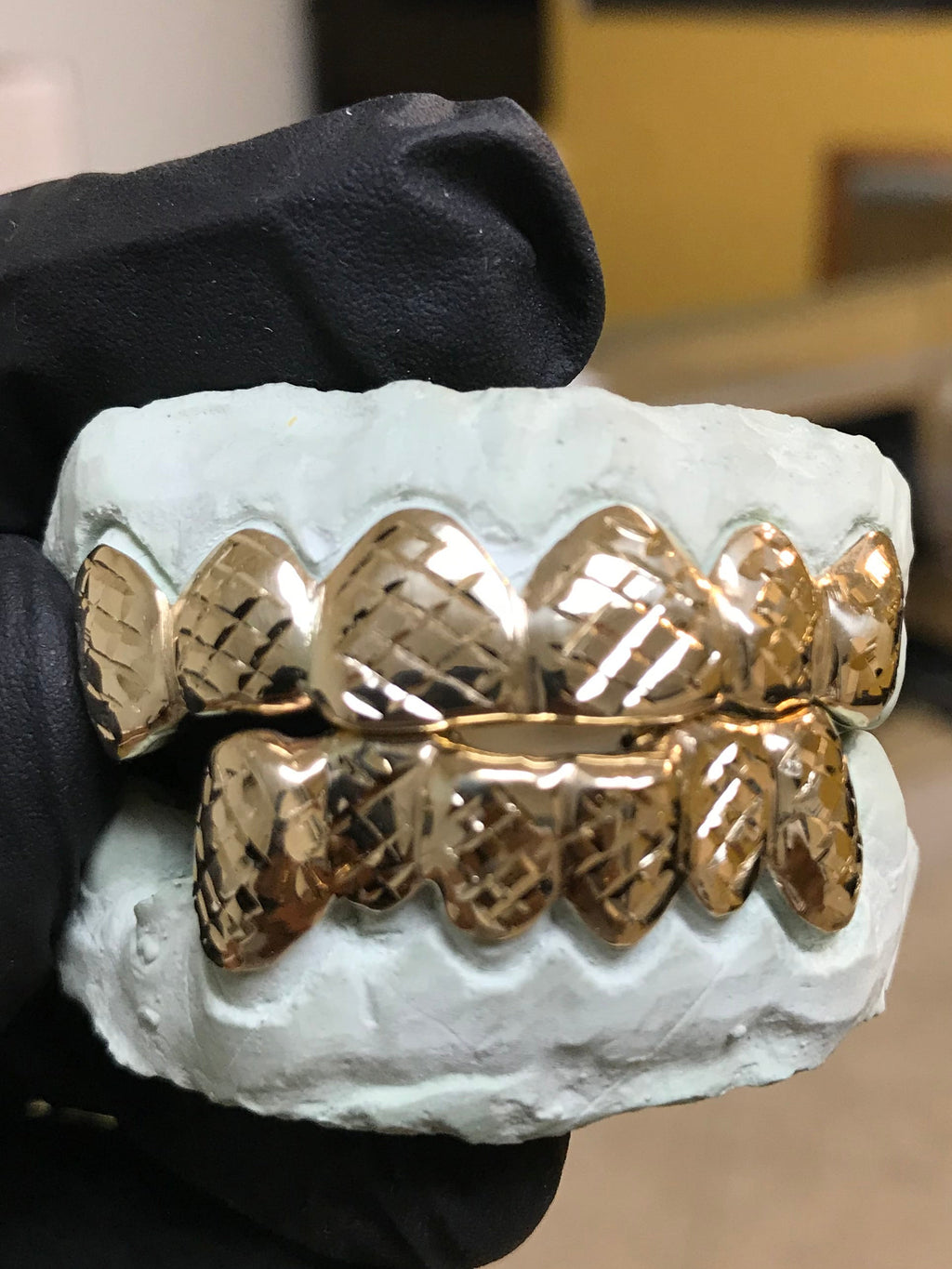 6 Top 6 Bottom 10k Gold
