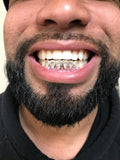 6 Sterling Silver Teeth w/ Diamond Cut
