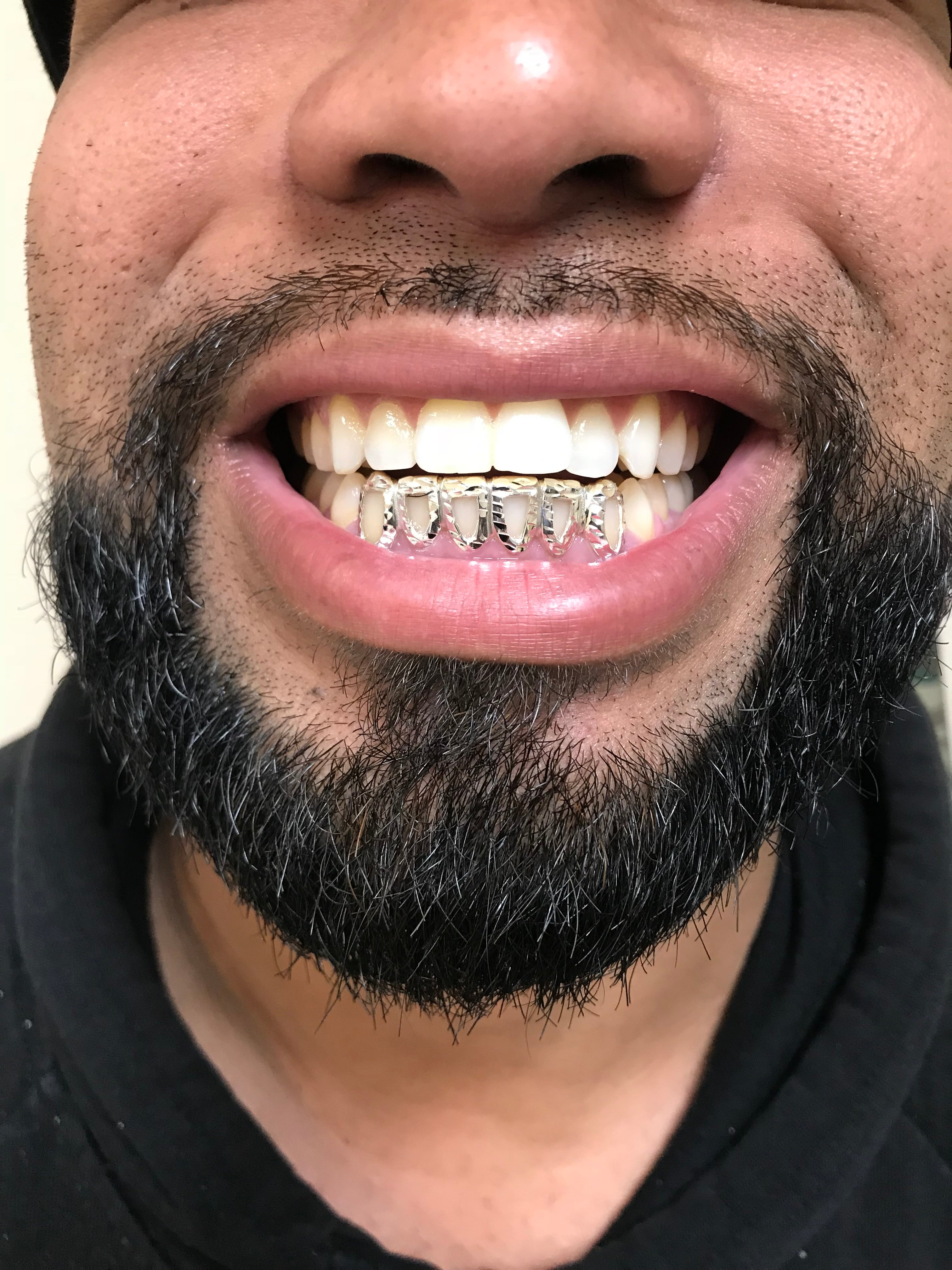 6 Sterling Silver Teeth w/ Diamond Cut