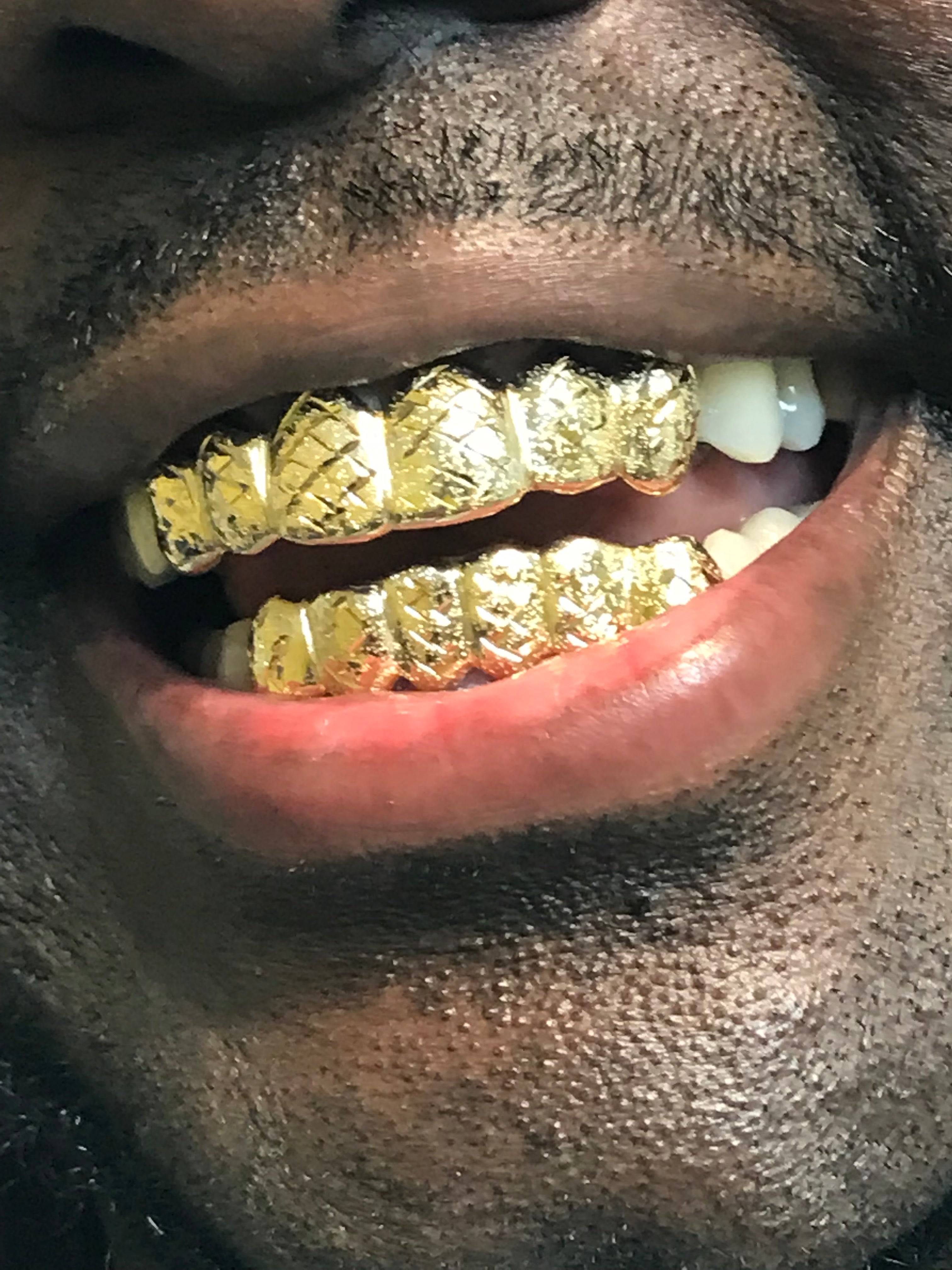 6 Top 6 Bottom 10k Gold